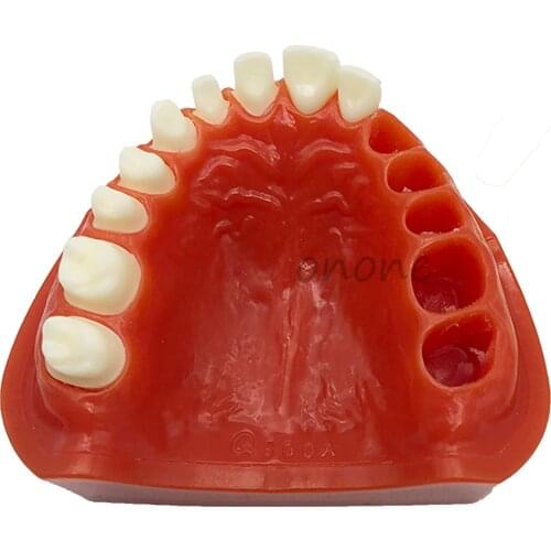 Dental Teeth Removable Standard Teeth Tooth Model Teeth Student Learning Model