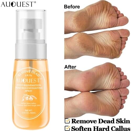 Joypretty Foot Care Products