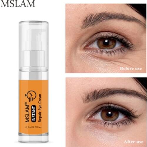 MSLAM Instantly Repair Eye Serum Remove Dark Circles Firming Eye Skin Anti Puffiness Eye Gel Moisturizing Anti-Wrinkle Eye Cream