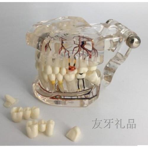 Tooth model Adult transparent pathophysiological model Repair models Teaching demonstration free shipping