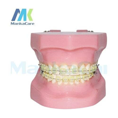 Manka Care - 28 pcs Tooth, all ceramic bracket Oral Model Teeth Tooth Model