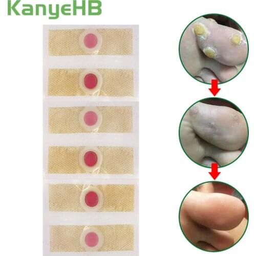 30pcs Foot Care Medical Plaster Foot Corn Removal Remover Warts Thorn Plaster Of Calluses Patches Detox Foot Pad Plasters A175