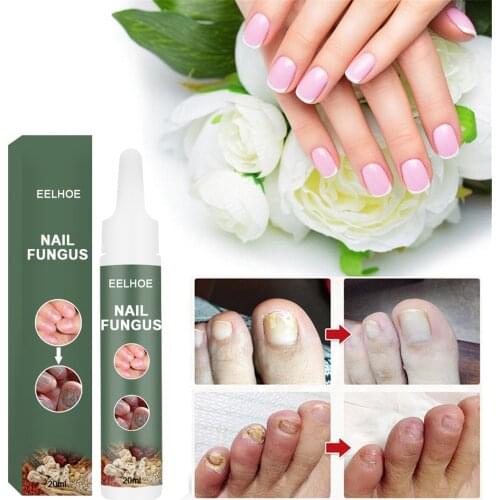 20ml Nail Care Cream Healthy Safe Nail Repair Essence Natural Nail Antibacterial Serum Fungal Nail Treatment Serum