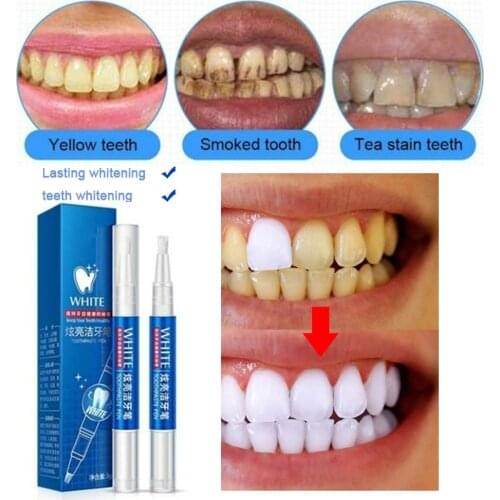 Teeth Whitening Pen Remove Plaque Stains Oral Hygiene Cleaning Serum Dental Tool Teeth Whitener Oral CareTeeth Whitening Machine