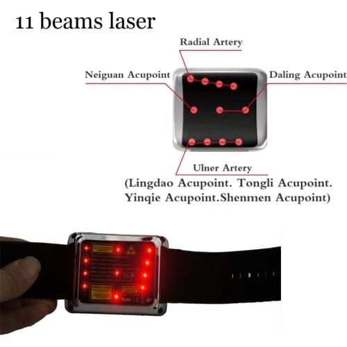 Tinnitus Menieres syndrome medical lllt laser for sale laser acupuncture laser wrist watch