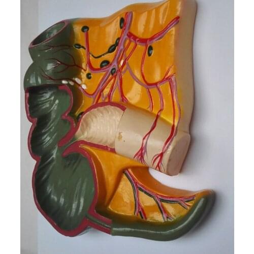 Human Cecum and Appendix Model Ileum Model Lymphatic and Gastrointestinal Teaching Model Intestinal Models Medical Teaching