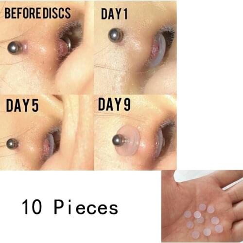 10 Pieces Silicone Piercing Healing Discs Flexible Anti Hyperplasia Saucer Ear Nose Soft Gasket Tragus Anti Invagination