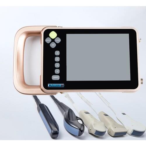 S7 Cattle Sonar Scanner Veterinary Portable Uterus Scanner WATERPROOF SHEEP Pregnancy Tester Fetus PIG Animal Sonar Color FARM