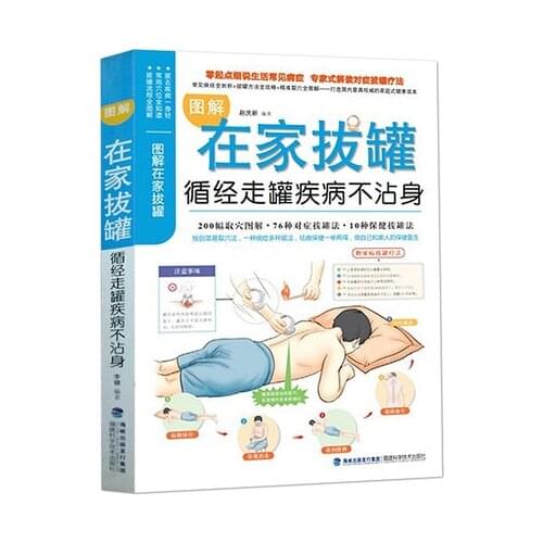 Illustrated Book for Home Cupping (Chinese Edition)