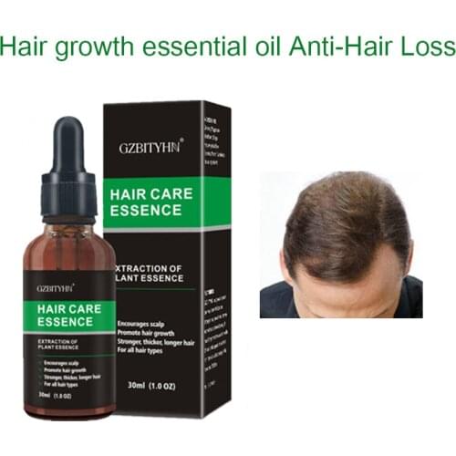 30ml New Hair Growth Essence Oil Fast Powerful Hair Growth Oil Products Essential Oil Treatment Preventing Hair Loss Hair Care