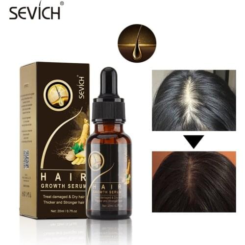 Sevich Hair Growth Oil Anti Hair Loss Serum Hair Growth for Men/Women Hair Care Products Hair Extension Oil Hair Care Products