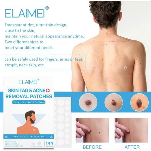 144 Patches Skin Tag Remover Patch Remove Mole Ance Pimple Patch Plaster Hydrocolloid Master Anti-infection Quick Absorb