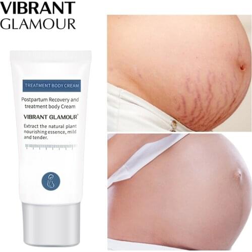 VIBRANT GLAMOUR Remove Pregnancy Scars Acne Cream Stretch Marks Repair Anti-Aging Anti Winkles Firming Body Creams 30g TSLM2