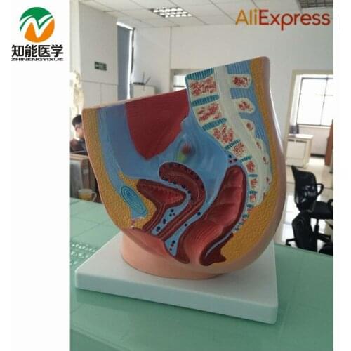 BIX-A1065 MQ84 Women Sagittal Anatomy