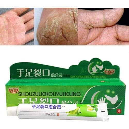 Powerful Hand Foot Crack Cream Heel Chapped Peeling Foot And Hand Repair Anti Dry Crack Skin Care Chinese Ointment