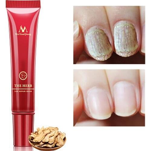 15g Nail Herbal Repair Cream Anti Fungal Remove Onychomycosis Toe Nourishing Brighten Cuticle Revitalizer Hand Foot Nail Care