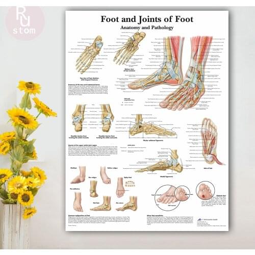 Foot Joints of Foot Chart Anatomy Pathology Poster Canvas Painting Wall Pictures for Medical Education Doctors Office Classroom