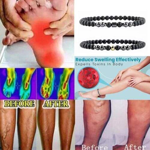 23.5CM Magnetic Anti Varicose Swelling Magnet Therapy Anklet Magnetic Prevent Varicose Veins Swelling Blood Circulation Anklet