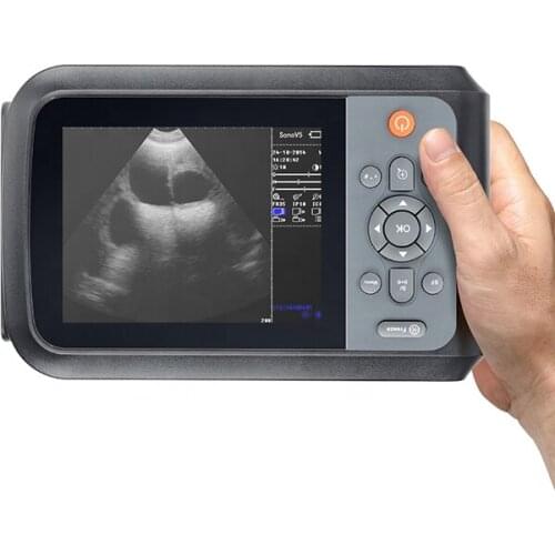 Medical Ultrasound Instruments Portable vet Machine portable Ultrasound Scanner