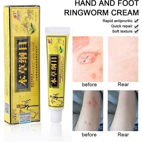 QICAOGANGMU Skin Psoriasis Cream Dermatitis Eczematoid Eczema Ointment Treatment Psoriasis scaly plaque psoriasi cream