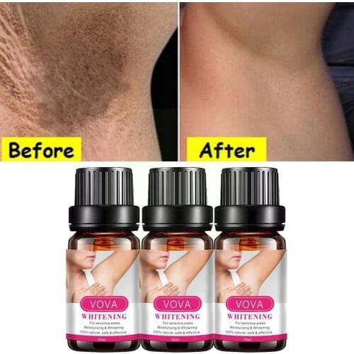 Armpit Whitening Oil Skin Lightening Bleaching Cream Legs Body Underarm Essential Knees Oil Intimate Dark Skin Whitening B5T9