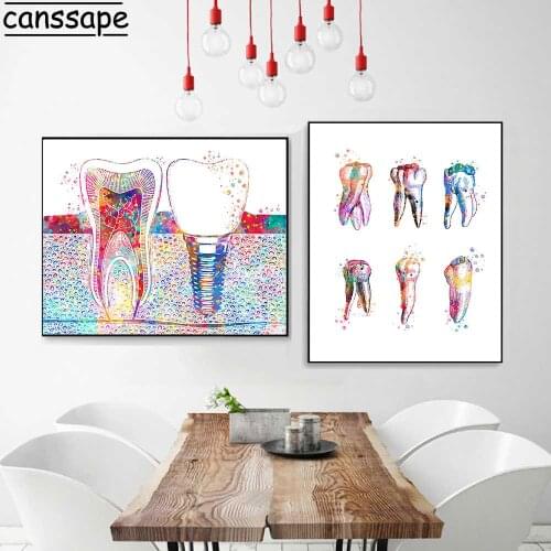 Dental Art Picture Tooth Implant Canvas Print Dentist Wall Art Painting Medicine Hygienist Poster Tooth Watercolor Clinic Decor