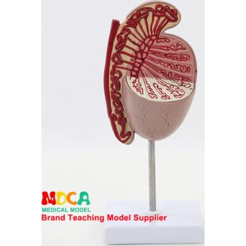 MSZXT009: Testicular Enlargement Sperm Cord Andrology Teaching in Reproductive Urology Department of Testicular Model