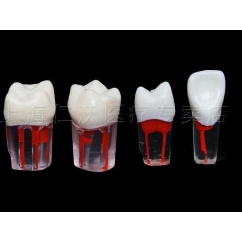 Exam practice preparation hole with pulp cavity pulp particles Full mouth simulation tooth model Isolated tooth open pulp