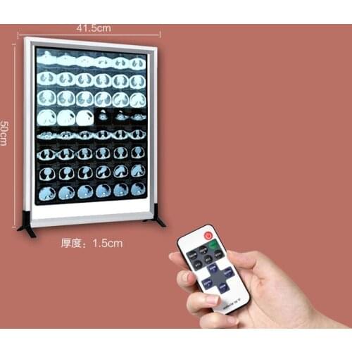 Remote Control X-Ray Film Illuminator Dental Orthopaedic Hospital Ultra-Thin LED XRay Film Viewing Lamp Box Film Viewer 220V