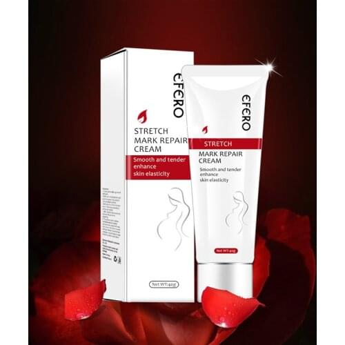 Stretch Mark Repair Cream Remover Removal Scar Body Skin Care for Pregnancy Women SSwell