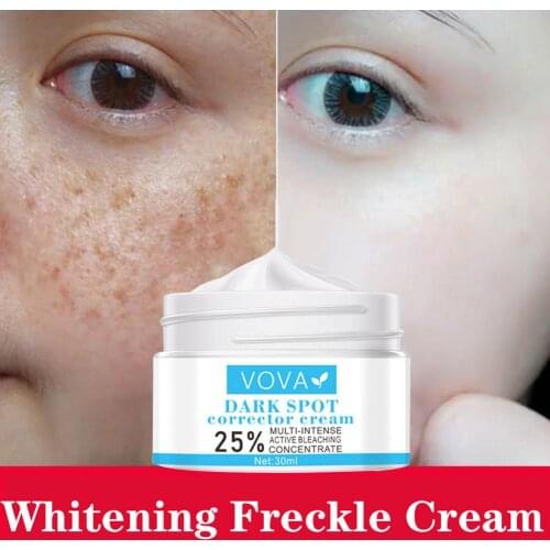 Freckle Whitening Cream Mild Refreshing Dark Spot Corrector Cream Extract A Variety Of Plant Essences Reduce Skin Pigmentation