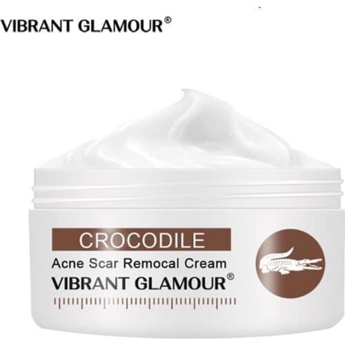 Крема от растяжек VIBRANT GLAMOUR China At AliExpress