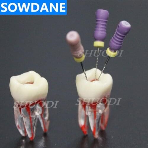 1:1 Resin Dental Endodontic Student Study Practice Model with Colored Root Canal and Pulp Transparent Models without files