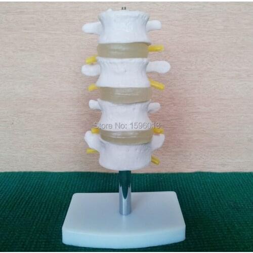 HOT lumbar vertebra Model 4 pcs, Lumbar Set(4 pcs) model,Lumbar model