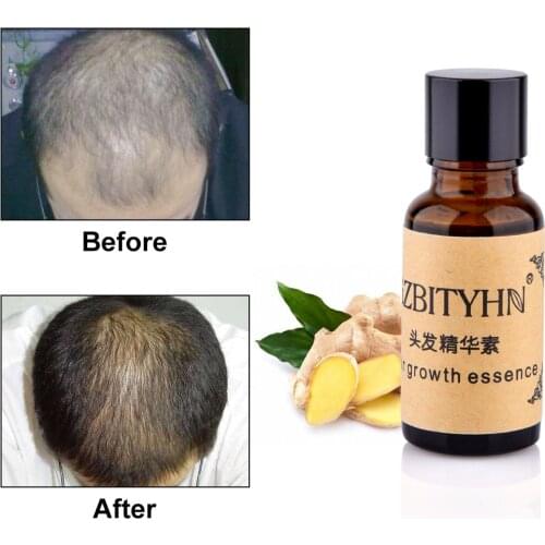 Hair Growth Essence Anti Hair Loss Liquid 20ml Dense Hair Hairstyle Keratin Hair Care Styling Products Sunburst Salon Beauty
