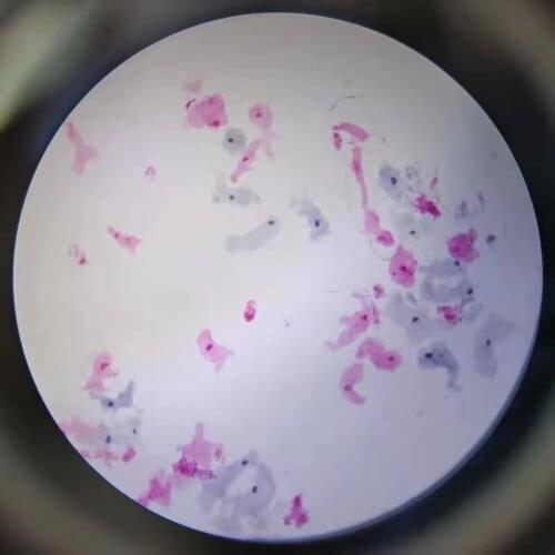 10pcs Amoeba Glass Microscope Prepared Parasitology Slides for Educational Teaching