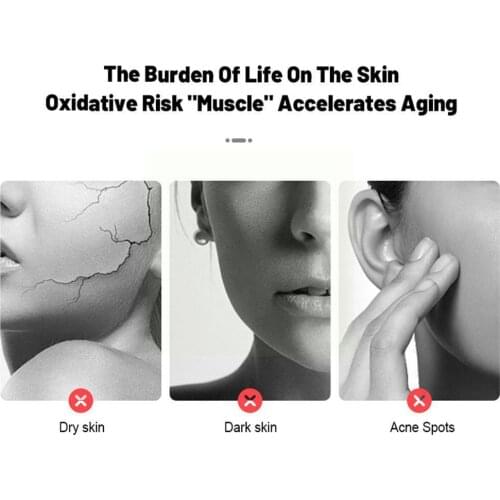 Arbutin Skin Whitening Serum Lightening Kojic Acid Spot Cream 30Ml Bleaching Serum Dark Brightening E5R2