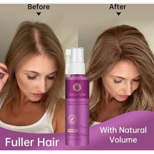 Anti Hair Loss Essence Spray Hair Growth Treatment Oil Fast Thick Hair Eyebrow Growth Plant Health Hair Care Tonic for Men/Women