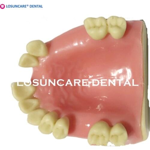 Dental Teeth Planting Practice Model Lower Jaw Implant Model With Soft Gum Dentist For Medical Dental Education