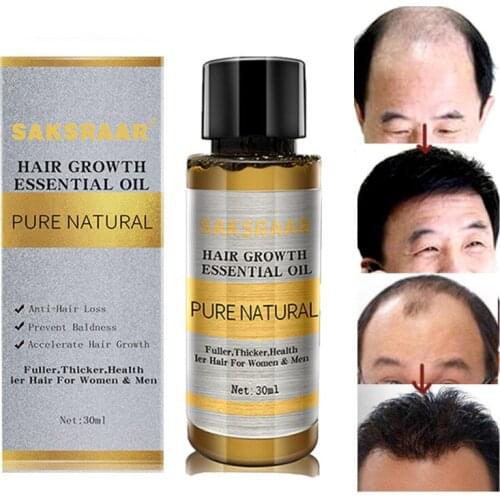 Hair Growth Essential Oils Essence Original Authentic 100% Hair Loss Liquid Health Care Beauty Dense Hair Growth Serum