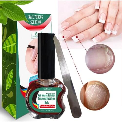 Nail Fungal Treatment Repair Essence Serum Anti Infection Paronychia Onychomycosis Treatment Care Foot Nail Fungus Removal Gel