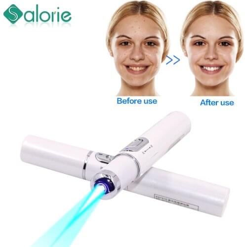 Acne Laser Pen Portable Wrinkle Removal Machine Durable Soft Scar Remover Device Light Therapy Pen Massage Relax Blue/Red