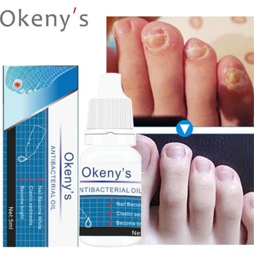 3 Days Effect Fungus Removal Essence Liquid Fungal Nail Treatment Bright Nail Repair Anti Infection Foot Caring Onychomycosis