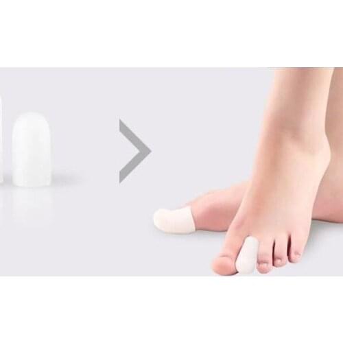 OHIWYBRACE Callus Plasters