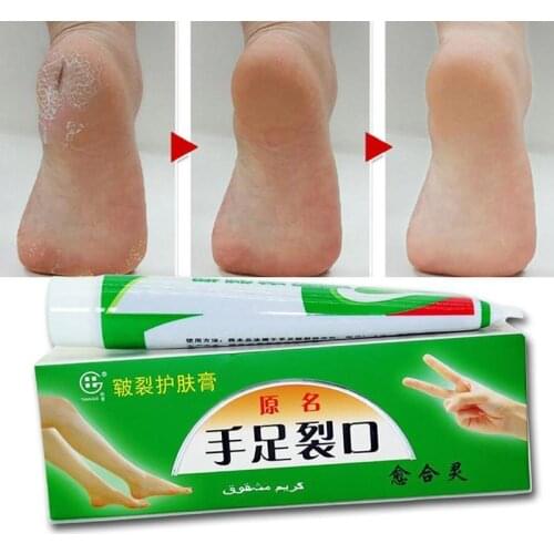 Repairing Moisturizer Foot Cream Anti-chapping Skin For Rough Dry Cracked Chapped Feet Heel Hand Foot Cleft Healing Useful Oil
