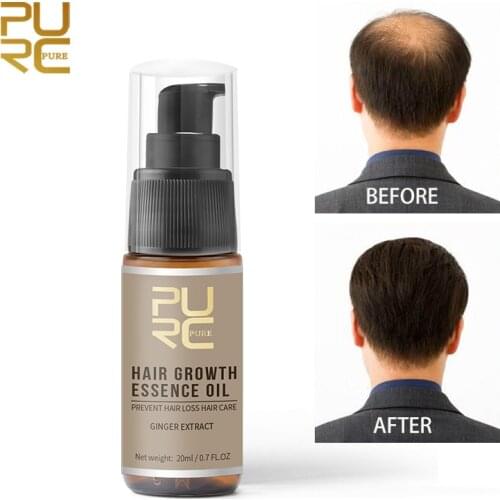 PURC Hot sale Fast Hair Growth Essence Oil Hair Loss Treatment Help for hair Growth Hair Care 20ml