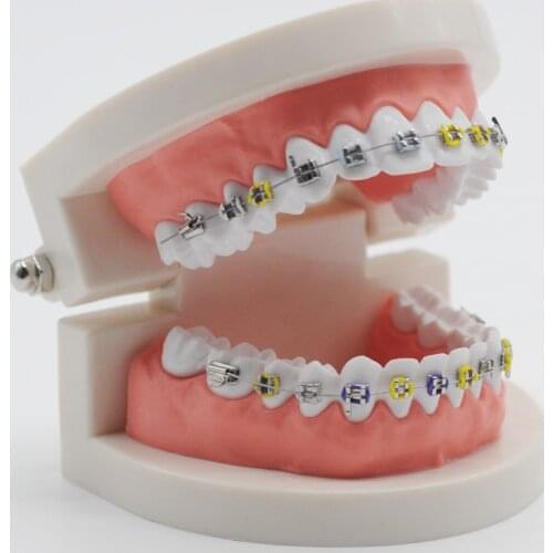 Dental Buccal Tube Orthodontic Treatment Teeth Model Ortho Metal Bracket Arch Wire Ligature Tie Dentist Lab