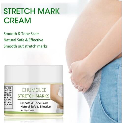 Dimollaure Cream For Stretch Marks