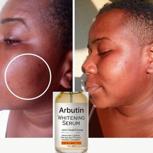 HEYXI Whitening Face Serum