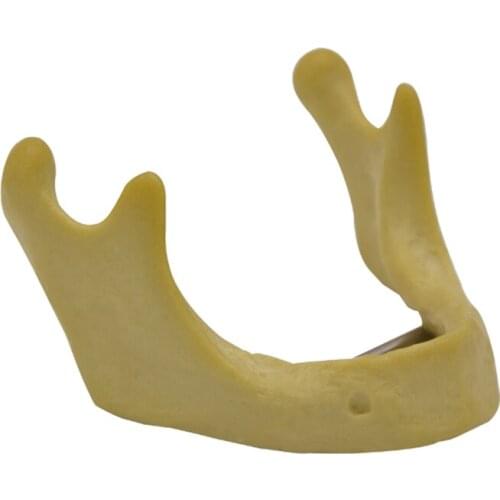 Chin bone Orthopedic model Bionic mandibular implant practice Simulated mandible teaching model